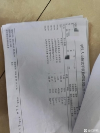 我这种是低病毒症。还是肝硬化
